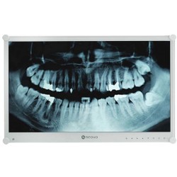 Buy DENTAL MONITOR - DR-24G in Cyprus, Nicosia, Limassol, Larnaka, Pafos